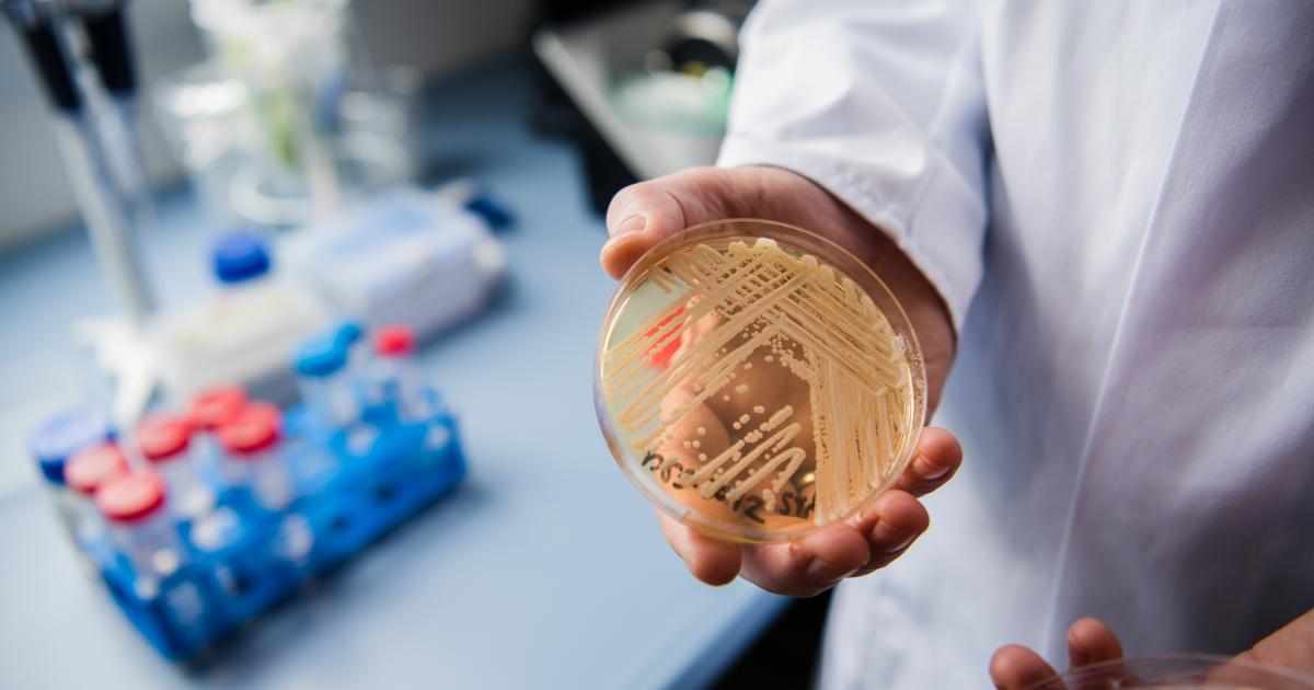 Un investigador sostiene una placa con el hongo Candida auris en un laboratorio de Alemania.