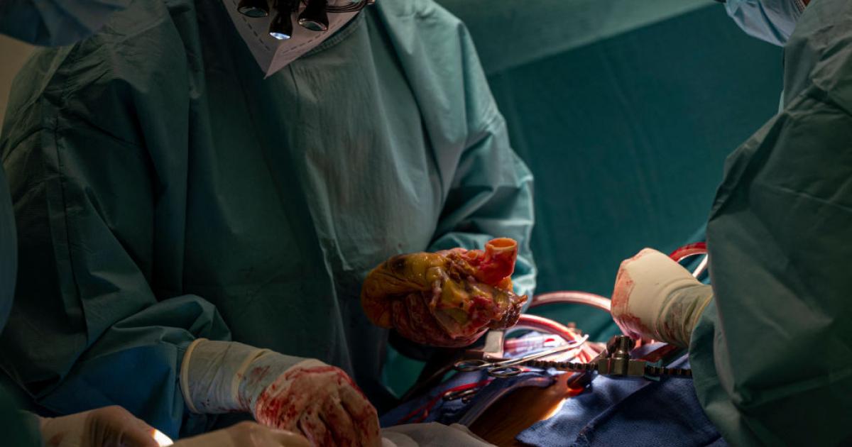 Imagen de un trasplante de corazón en el Hospital Puerta de Hierro