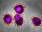 Por qué los virus (y el coronavirus) son tan difíciles de tratar en comparación con las bacterias