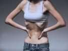 La anorexia nerviosa no solo es un problema psiquiátrico