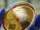 Los síntomas que produce el estreptococo A, la bacteria que preocupa por su expansión en Japón