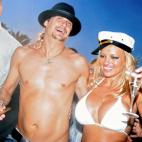 Pamela Anderson y su ex Kid Rock pasándoselo pipa en su boda, celebrada en Saint Tropez, al sur de Francia. Bravo para ella, por darle una oportunidad a un bikini como traje nupcial. (2006)