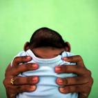 Febrero de 2016. Imagen de un ni&ntilde;o nacido con microcefalia en Brasil por el virus del zika.
