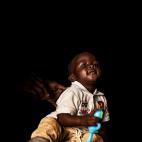 Youssouf, 1 año (Mali)