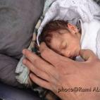 La ONU también difundió la imagen de Amira, una pequeña de dos meses de edad, rescatada de Yarmouk, que apenas pesaba un kilo. Fuera del cerco, pudo recuperarse lentamente. Sus padres la llaman "la niña del asedio", engendrada y parida entre...