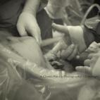 El padre sacó una foto que captura el momento preciso en el que la niña agarra con la mano el dedo del cirujano a través del vientre abierto de la madre.