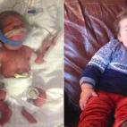 "Mis hijos gemelos, Breckin y Cameron, nacieron cuando estaba embarazada de 30 semanas. Pesaron 1,39 kilos y tuvieron que quedarse 54 días en la UCIN. Ahora tienen 21 meses y están sanos y felices."
