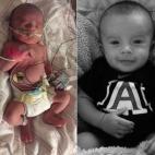 "Mi hijo Seth Thomas Pender Jr. nació el 2 de agosto de 2015, a las 33 semanas de embarazo. Pasó 16 largos días en la Unidad de Cuidados Intensivos Neonatales. Al nacer, pesó 2,8 kilos, pero llegó a pesar 2,1 kilos estando en la UCIN. Ahora...