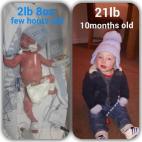 Izquierda: 1,1 kilos, unas pocas horas después de nace. Derecha: 9,5 kilos, 10 meses. 
"Mi hijo Junior nació a las 28 semanas de embarazo; pesó 1,1 kilos. Estuvo en la UCIN dos semanas, después pasó una semana con CPAP (un aparato para trat...