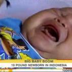 Akbar nació en octubre de 2009 y se alzó con el título de bebé más grande de Indonesia. Su madre, Jakarta, padeció de diabetes en la fase de gestación.