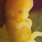 Un equipo de investigadores chinos publicó en abril el primer intento de modificar embriones humanos empleando un sistema de reciente creación que está llamado a revolucionar la ingeniería genética. Se utilizaron embriones no viables, pero ...