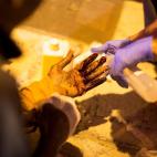 Un trabajador de la Cruz Roja asiste a un migrante que result&oacute; herido al cruzar, con profundos cortes en su mano.