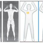La imagen de la derecha es producida por el tipo de escáner que se estará usando, a diferencia de la imagen de la izquierda, que muestra cuerpos desnudos.