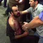 Piquete herido tras un enfrentamiento con la policía en la huelga general de 2002 frente a la sede de UGT en Madrid.