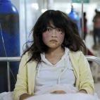 Song Xuxia, de 19 años, hospitalizada tras el terremoto de magnitud 6,6 que sacudió el condado de Minxian, en Dingxi, en la provincia de Gansu, 23 de julio
