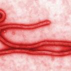 Tras el primer contagio por ébola fuera del continente africano, son muchas las cuestiones que surgen alrededor de esta enfermedad. ¿Por qué ha habido transmisión del virus? ¿Qué debemos hacer ahora? Éstas son las preguntas para entender ...