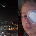 La "proyección de haces de luz" sobre pilotos o conductores se considera infracción muy grave. Los manifestantes de la imagen de la izquierda -que son egipcios y estaban en la plaza Tahrir, en El Cairo, donde usaron láseres para enviar mensaj...