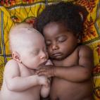 Un bebé albino de 3 semanas junto a su primo en Congo. 
