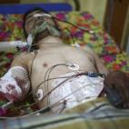 Una ONG de ayuda en Siria denunció en enero el bombardeo incesante en hospitales. Estima que se han destruido unos 177 hospitales y han matado a cerca de 700 trabajadores sanitarios desde 2011.