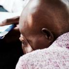Emily Mkumbaâ, con enormes problemas de mobilidad por su enfermedad, recibe la visita de MSF en Machinjiri. (Emily murió en mayo 2020).