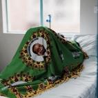 Una paciente recibe cuidados paliativos en el Queen Elizabeth Central Hospital.