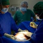 MSF ha puesto en marcha un quirófano en el Queen Elizabeth Central Hospital in Blantyre, especializado en ginecología.