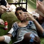 Un niño herido es atendido en el hospital Taamin Sehi durante los enfrentamientos entre partidarios de Morsi y miembros de las fuerzas de seguridad egipcias.