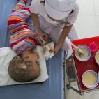 Pham Thi Phuong es alimentado en el hospital de Ho Chi Minh City. Su condición de salud es consecuencia de la exposición de sus padres al agente naranja. 