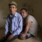 Nguyen Hong Phuc, ex soldado de 63 años, sentado en la cama de su hijo Nguyen Dinh Loc, de 20, que se recupera de la operación de un tumor en las afueras de Hanoi. Nguyen Dinh Loc y sus descendientes tienen problemas porque el abuelo estuvo ex...