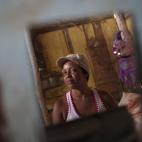 Evelina González , en Maracay, Venezuela lucha contra la crisis económica del día a día y con problemas de salud después de ser diagnosticada con cáncer de seno.