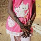 Una niña está esperando a que la henna se seque. La henna se ha cultivado y utilizado en el sur de Egipto, y en particular en Nubia, desde la antigüedad. Es un colorante que se utiliza en las manos, los pies y en las diferentes partes del cue...