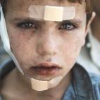 Jalid, un niño afgano herido por las bombas de la OTAN.