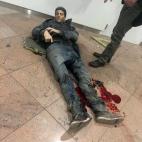 Un hombre herido en el aeropuerto de Bruselas. Imagen de Georgian Public Broadcaster, fotografía de Ketevan Kardava.