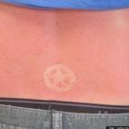 Recordatorio: los tatuajes solares no son buenos para la piel... ni bonitos