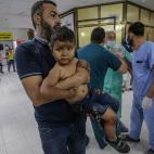 Un ni&ntilde;o palestino herido, en el hospital Al-Shifa para recibir tratamiento despu&eacute;s de un ataque a&eacute;reo israel&iacute; en la ciudad de Gaza.