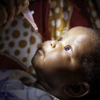 Rusia podría vacunar al menos a 92.000 millones de niños en el mundo entero. Según Marci Greenberg, de UNICEF, administrar una sola dosis oral de la vacuna contra la polio cuesta 0.18 dólares. La Organización Mundial de la Salud dice que se...