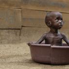 Según el Programa Mundial de Alimentos, uno de cada seis niños en los países en vías de desarrollo está por debajo de su peso. La malnutrición y la desnutrición están implicadas en el 45% de las muertes de niños de menos de 5 años en t...
