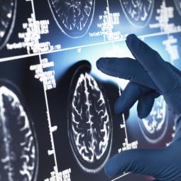 Los expertos alertan que el 'asesino silencioso' del cerebro es este simple alimento: cada español devora 29 kilos por año