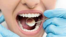 El medicamento que regenera los dientes 'jubila' a los implantes