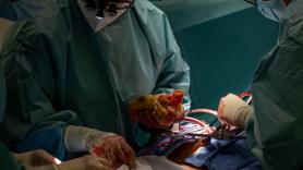 Un récord 'Marca España': la sanidad española logra un nuevo tope de trasplantes en un día
