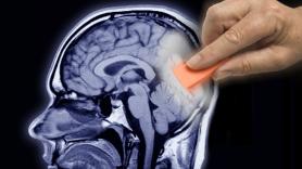 Investigadores alzan la voz por la prueba por imágenes que podría aumentar las probabilidades de desarrollar cáncer