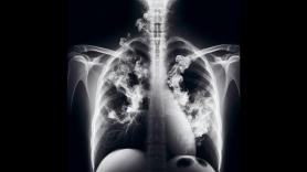 Los expertos descubren el gran 'pero' del mito que asegura que los pulmones se regeneran cuando dejas de fumar