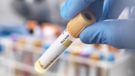 Salud investiga un posible brote de hepatitis A en Jumilla (Murcia)