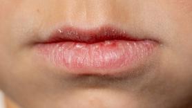 La infravalorada señal que viene de los labios e indica que debes beber agua inmediatamente