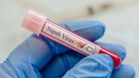 La OMS pone el foco en el virus del Nipah tras la muerte de una joven de 18 años