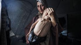 La denuncia de cien ONG: los habitantes de Gaza se están "consumiendo" a medida que se extiende la "hambruna masiva"