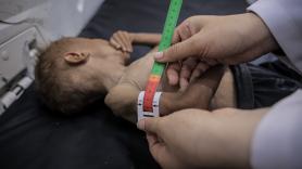 El Gobierno prepara un avión medicalizado para transportar a 13 niños gazatíes a España para ser tratados
