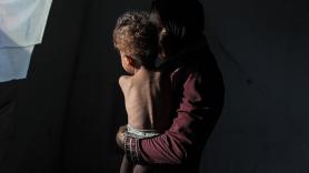 Ya son cien los niños muertos en Gaza por desnutrición desde el inicio de la ofensiva