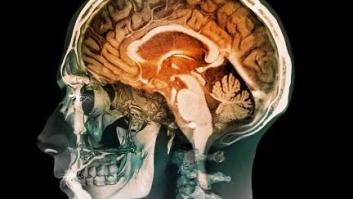 El cerebro puede resucitar sin el cuerpo