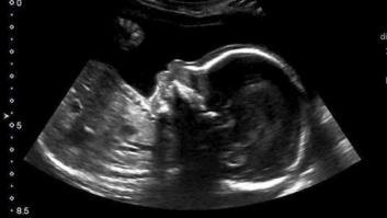 Este bebé tiene un mensaje para sus padres desde dentro del útero